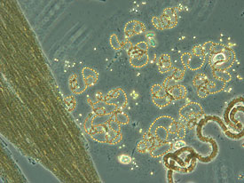 Cyanobacteria. Picture: Minna Ylä-Jarkko.